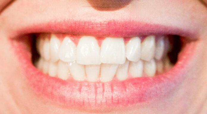 Soñar con Muelas | Significado e interpretaciones más comunes Soñar con Muelas