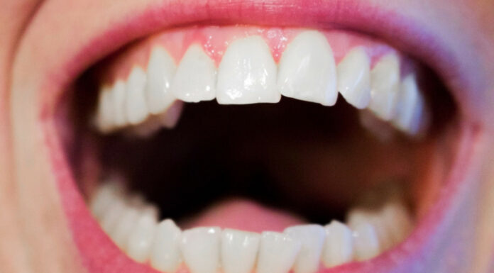 Soñar con Dientes Flojos | Significado e interpretaciones más comunes Soñar con Dientes Flojos